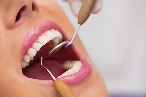 estética dental