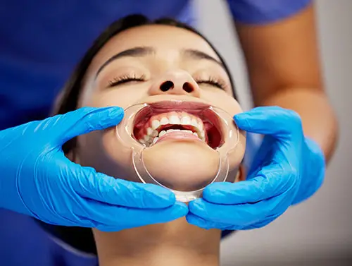 rehabilitacion oral